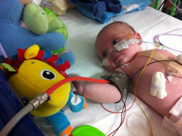 Baby Thomas Passant in Birmingham Childrens Hospital